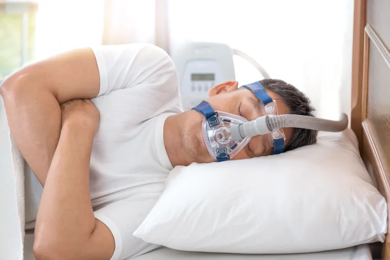 Patient sleeping with a CPAP mask for sleep apnea therapy